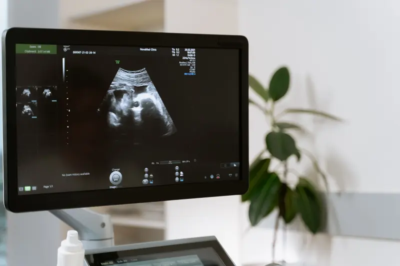 Medical ultrasound scan showing a fetus on a monitor in a clinic setting